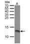 Replication Protein A3 antibody, NBP1-32023, Novus Biologicals, Western Blot image 