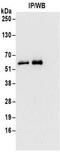 RB2K antibody, NBP2-32163, Novus Biologicals, Immunoprecipitation image 