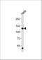 Fibroblast Growth Factor Receptor 1 antibody, M00098-1, Boster Biological Technology, Western Blot image 