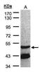 G Protein Subunit Alpha L antibody, PA5-27964, Invitrogen Antibodies, Western Blot image 