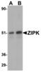 Death Associated Protein Kinase 3 antibody, 2431, QED Bioscience, Western Blot image 