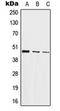 Jun Proto-Oncogene, AP-1 Transcription Factor Subunit antibody, orb214140, Biorbyt, Western Blot image 
