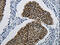 Damage Specific DNA Binding Protein 1 antibody, CSB-PA056628, Cusabio, Immunohistochemistry paraffin image 