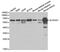 Aldehyde Dehydrogenase 4 Family Member A1 antibody, A2595, ABclonal Technology, Western Blot image 