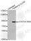 Signal Transducer And Activator Of Transcription 5A antibody, AP0138, ABclonal Technology, Western Blot image 