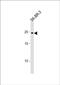 RAB32, Member RAS Oncogene Family antibody, PA5-48865, Invitrogen Antibodies, Western Blot image 