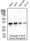 Apurinic/Apyrimidinic Endodeoxyribonuclease 1 antibody, NB100-116, Novus Biologicals, Western Blot image 