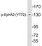 Ephrin type-A receptor 2 antibody, LS-C291497, Lifespan Biosciences, Western Blot image 