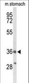 Bombesin Receptor Subtype 3 antibody, LS-C156864, Lifespan Biosciences, Western Blot image 