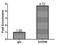 Signal Transducer And Activator Of Transcription 5B antibody, LS-C376711, Lifespan Biosciences, Chromatin Immunoprecipitation image 