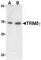 Tripartite Motif Containing 5 antibody, TA306150, Origene, Western Blot image 