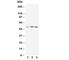 Nuclear Receptor Subfamily 1 Group H Member 3 antibody, R30350, NSJ Bioreagents, Western Blot image 