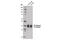 Sodium Voltage-Gated Channel Beta Subunit 1 antibody, 13950S, Cell Signaling Technology, Western Blot image 