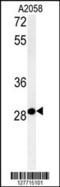 ADP Ribosylation Factor Like GTPase 14 Effector Protein antibody, 55-025, ProSci, Western Blot image 
