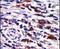 Protein Kinase C Eta antibody, PA5-13746, Invitrogen Antibodies, Immunohistochemistry paraffin image 