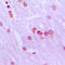 Bromodomain Containing 3 antibody, LS-C353038, Lifespan Biosciences, Immunohistochemistry frozen image 