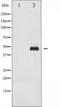 GATA Binding Protein 1 antibody, TA325497, Origene, Western Blot image 