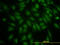 Phosphoinositide-3-Kinase Regulatory Subunit 4 antibody, LS-C133742, Lifespan Biosciences, Immunofluorescence image 