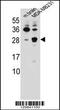 Cerebellin 2 Precursor antibody, 56-068, ProSci, Western Blot image 