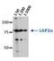 LAP2 antibody, orb76704, Biorbyt, Western Blot image 