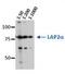 Thymopoietin antibody, orb76704, Biorbyt, Western Blot image 