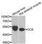 Glucokinase antibody, STJ28215, St John