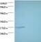 Proteasome Subunit Alpha 7 antibody, MBS715025, MyBioSource, Western Blot image 