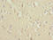 NADH:Ubiquinone Oxidoreductase Core Subunit V1 antibody, LS-C676143, Lifespan Biosciences, Immunohistochemistry paraffin image 