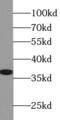 Apurinic/Apyrimidinic Endodeoxyribonuclease 1 antibody, FNab00480, FineTest, Western Blot image 