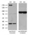 Sperm Associated Antigen 5 antibody, LS-C795459, Lifespan Biosciences, Western Blot image 