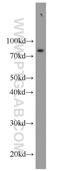 Interleukin 6 Receptor antibody, 23457-1-AP, Proteintech Group, Western Blot image 