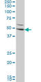 Dickkopf WNT Signaling Pathway Inhibitor 1 antibody, LS-C105116, Lifespan Biosciences, Western Blot image 