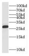 Proteasome Subunit Alpha 3 antibody, FNab06863, FineTest, Western Blot image 