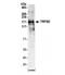 Transient Receptor Potential Cation Channel Subfamily M Member 2 antibody, NB500-241, Novus Biologicals, Western Blot image 