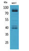 Interleukin 1 Receptor Type 1 antibody, A01092-1, Boster Biological Technology, Western Blot image 