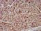 Twinkle protein, mitochondrial antibody, CSB-PA842754LA01HU, Cusabio, Immunohistochemistry paraffin image 