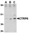 C1q And TNF Related 6 antibody, A12414-1, Boster Biological Technology, Western Blot image 