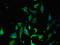 Lysyl-TRNA Synthetase antibody, LS-C394509, Lifespan Biosciences, Immunofluorescence image 