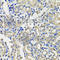 Secretogranin-3 antibody, A7799, ABclonal Technology, Immunohistochemistry paraffin image 