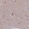 Clavesin 2 antibody, PA5-60501, Invitrogen Antibodies, Immunohistochemistry frozen image 
