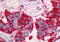 Neurotensin Receptor 1 antibody, MBS243849, MyBioSource, Immunohistochemistry paraffin image 