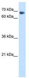 TATA-Box Binding Protein Associated Factor 6 antibody, TA337292, Origene, Western Blot image 