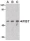 Golgi Associated PDZ And Coiled-Coil Motif Containing antibody, PA5-20180, Invitrogen Antibodies, Western Blot image 