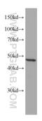 Isocitrate Dehydrogenase (NADP(+)) 1, Cytosolic antibody, 66197-1-Ig, Proteintech Group, Western Blot image 