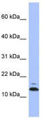 N-Acylsphingosine Amidohydrolase 1 antibody, TA344620, Origene, Western Blot image 