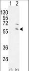 Ribosomal Protein S6 Kinase Like 1 antibody, LS-C162760, Lifespan Biosciences, Western Blot image 