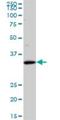 Sideroflexin 3 antibody, H00081855-M01, Novus Biologicals, Western Blot image 