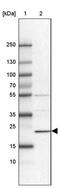 Heat Shock Protein Nuclear Import Factor Hikeshi antibody, PA5-57139, Invitrogen Antibodies, Western Blot image 