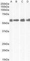 Corticotropin Releasing Hormone Receptor 1 antibody, GTX88961, GeneTex, Western Blot image 