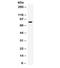 G Protein-Coupled Receptor Kinase 3 antibody, R32079, NSJ Bioreagents, Western Blot image 